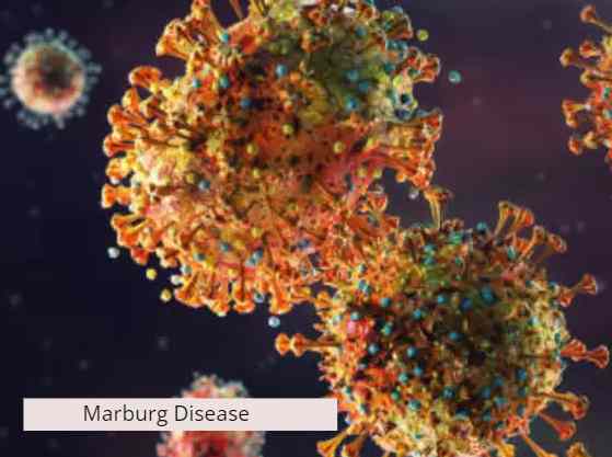 Marburg Disease