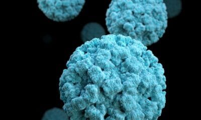 norovirus