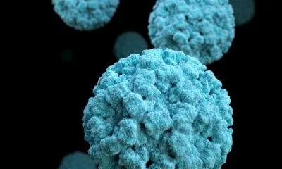 norovirus