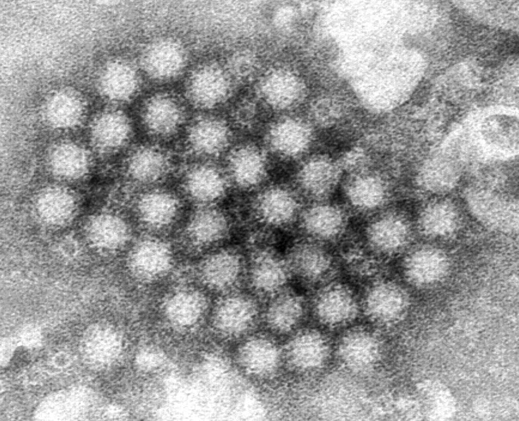 virus 1