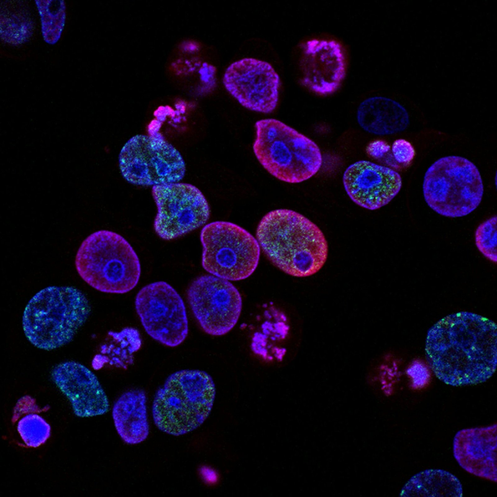 Understanding the Genetic Connections: DNA Traits and the Risk of Smoking-Related Cancers 95 smoking