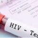 hiv