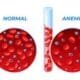 anaemia