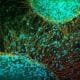stem cell
