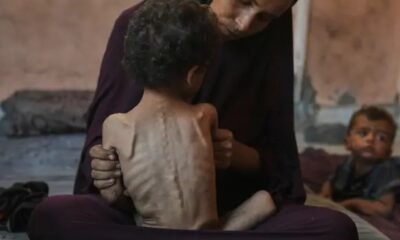 Gaza hunger crisis