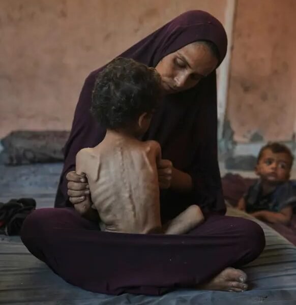 Gaza hunger crisis